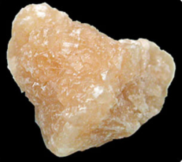 Cystine Kidney Stone Photo