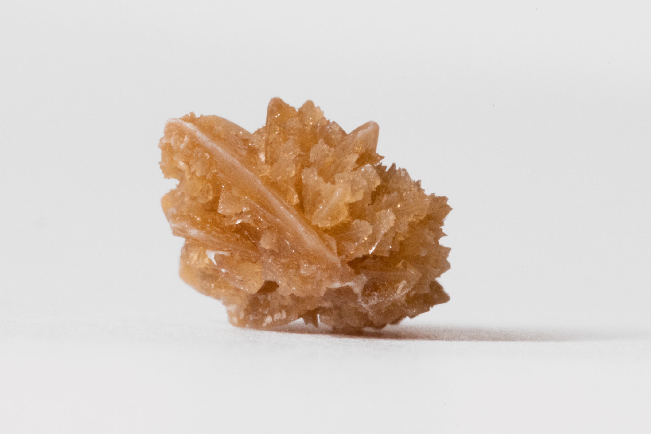 Uric Acid Kidney Stone Photo